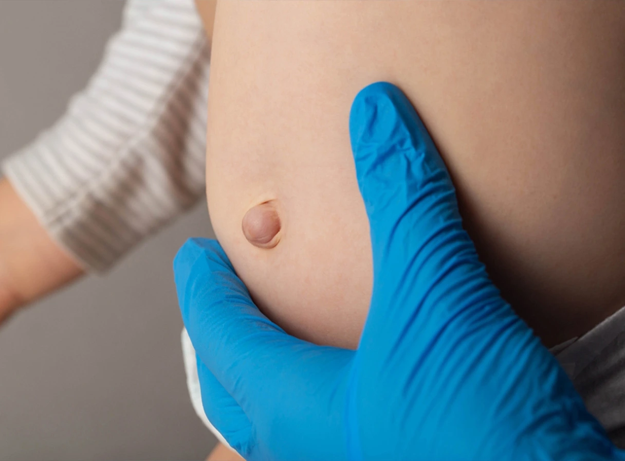 Hernia Surgery in Kolkata: Procedure, Types, Cost & Recovery Guide